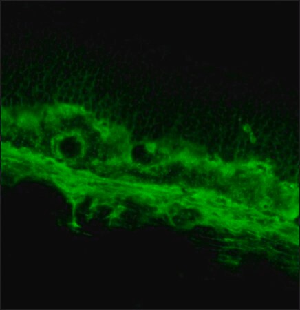 Merck Anti-Opsin antibody, Mouse monoclonal