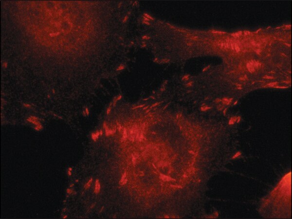 Merck Anti-Talin antibody,Mouse monoclonal