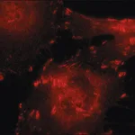 Merck Anti-Talin antibody,Mouse monoclonal