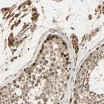 Merck Anti-GMEB2 antibody produced in rabbit