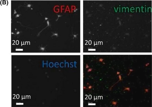 Merck Anti-Vimentin antibody produced in rabbit