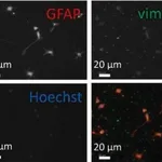 Merck Anti-Vimentin antibody produced in rabbit