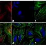 Thermo Fisher Scientific Donkey anti-Mouse IgG (H+L) Highly Cross-Adsorbed Secondary Antibody, Alexa Fluor 546