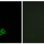 Merck ANTI-CXCR7 ANTIBODY PRODUCED IN RABBIT