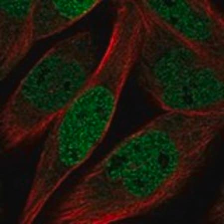 Merck Anti-KLHL11 antibody produced in rabbit