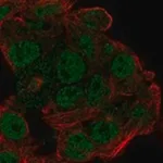 Merck Anti-EFCAB12 antibody produced in rabbit