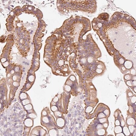 Merck Anti-OSR2 antibody produced in rabbit