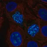 Merck Anti-ZNF202 antibody produced in rabbit
