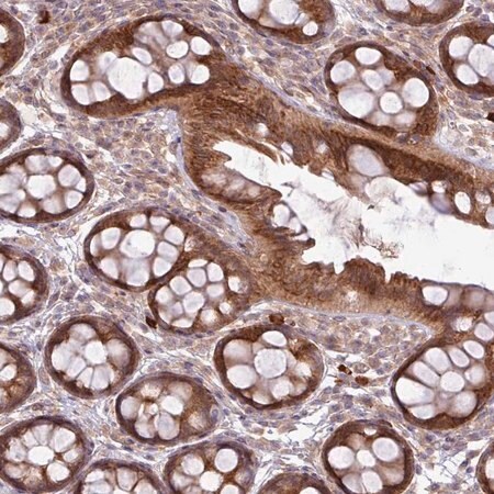 Merck Anti-FAM222B antibody produced in rabbit