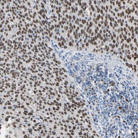 Merck Anti-ZKSCAN3 antibody produced in rabbit