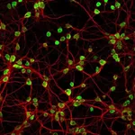 Thermo Fisher Scientific Donkey anti-Mouse IgG (H+L) Highly Cross-Adsorbed Secondary Antibody, Alexa Fluor Plus 488