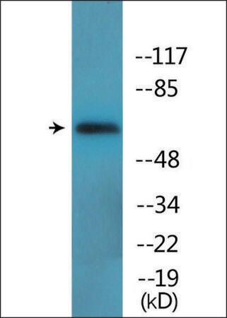 Merck Anti-phospho-Moesin/Ezrin/Radixin (pThr558) antibody produced in rabbit