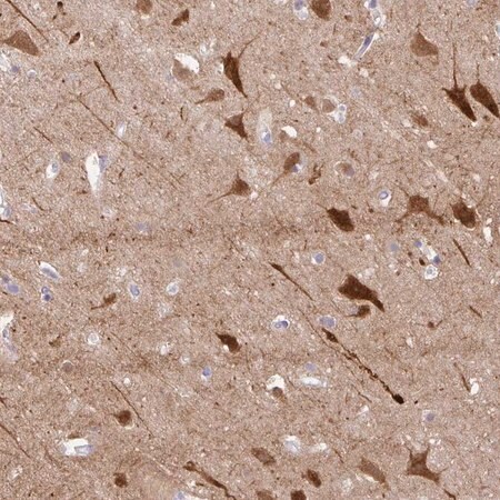Merck Anti-OR4N4 antibody produced in rabbit