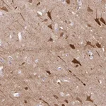 Merck Anti-OR4N4 antibody produced in rabbit
