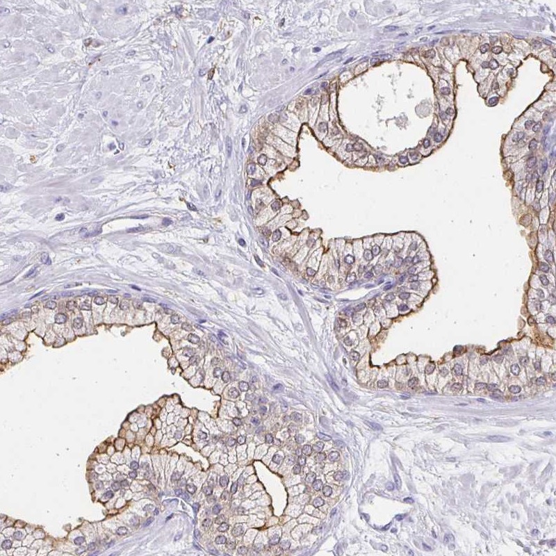 Atlas Antibodies Anti-TAS1R3 Antibody