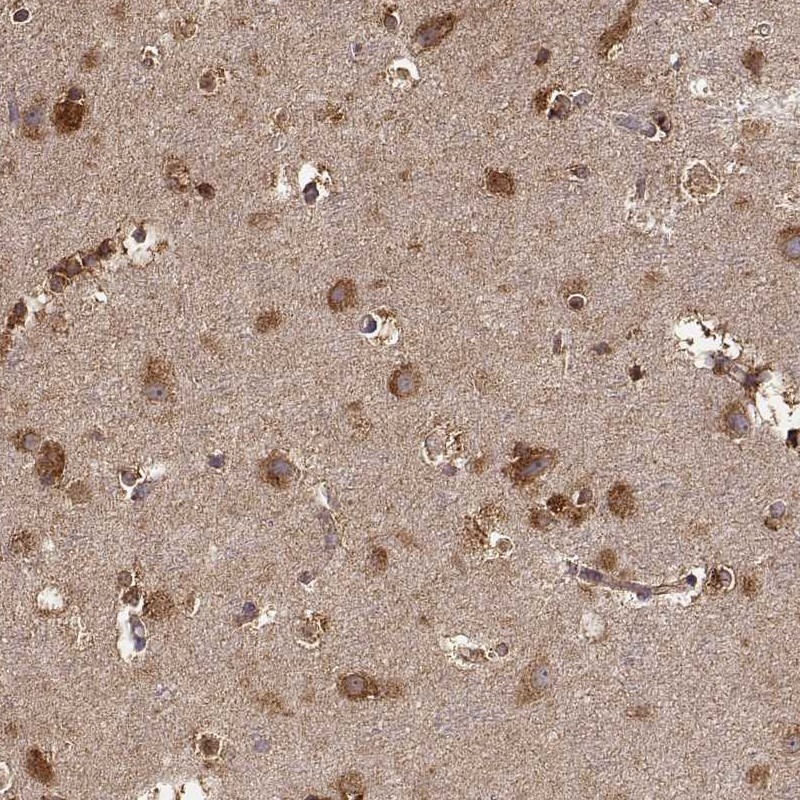 Atlas Antibodies Anti-TARSL2 Antibody