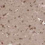 Atlas Antibodies Anti-TARSL2 Antibody