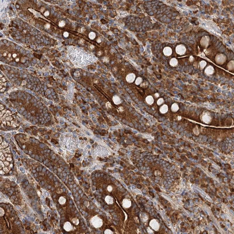 Atlas Antibodies Anti-TAS1R1 Antibody