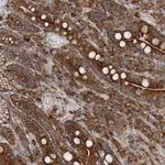 Atlas Antibodies Anti-TAS1R1 Antibody