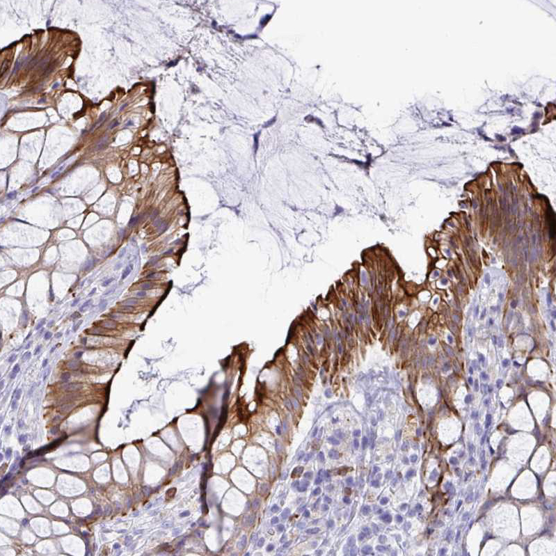 Atlas Antibodies Anti-TAS2R38 Antibody