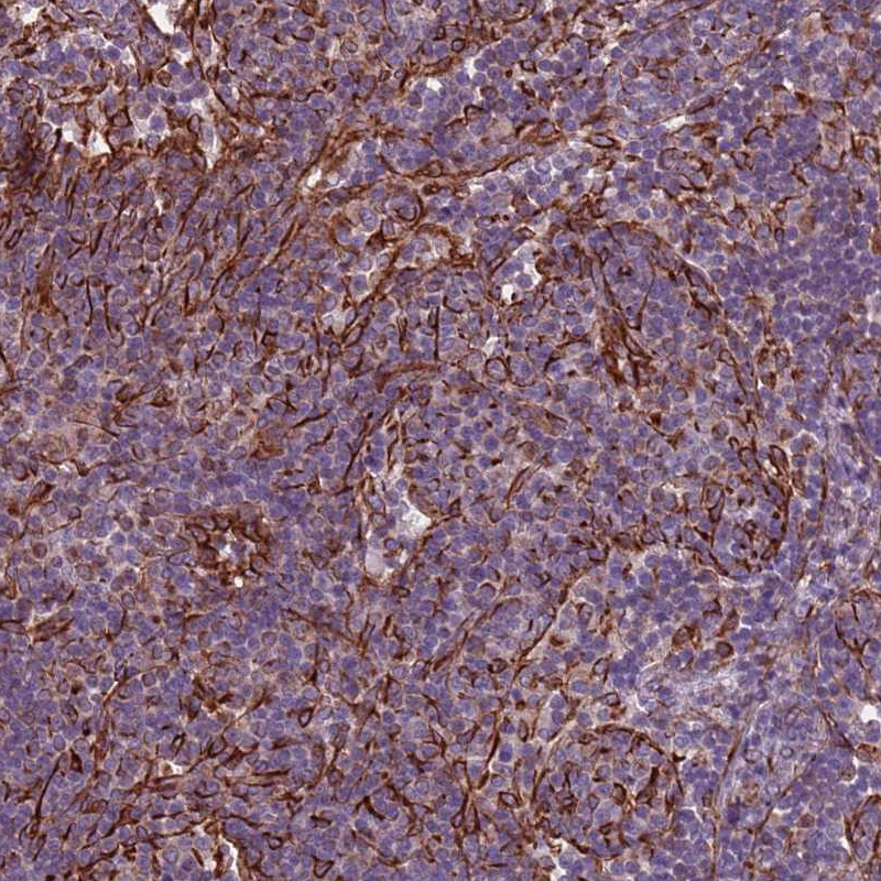 Atlas Antibodies Anti-TAS2R38 Antibody