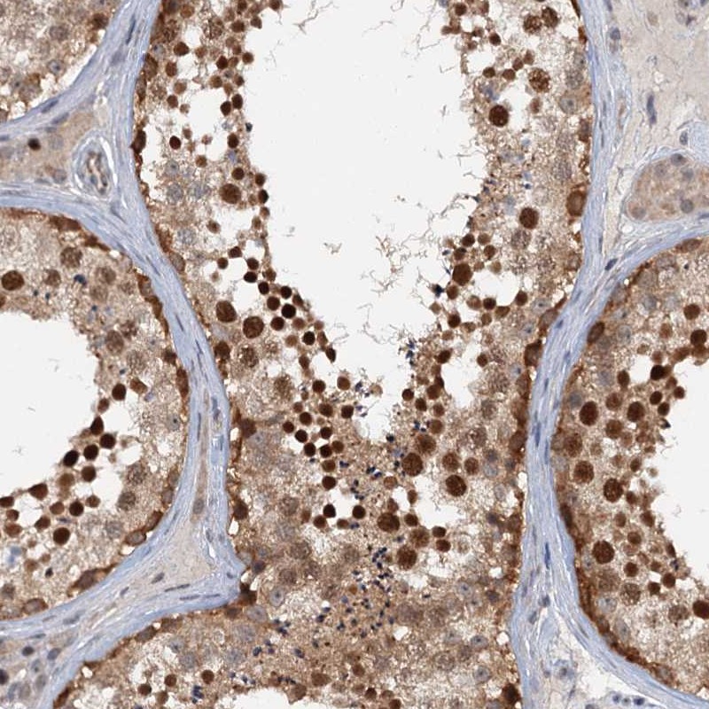 Atlas Antibodies Anti-TAS2R42 Antibody