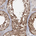Atlas Antibodies Anti-TAS2R42 Antibody
