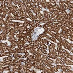 Atlas Antibodies Anti-TAS2R60 Antibody