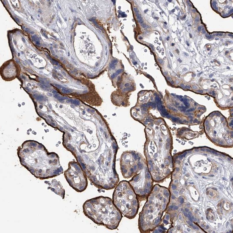 Atlas Antibodies Anti-TASP1 Antibody