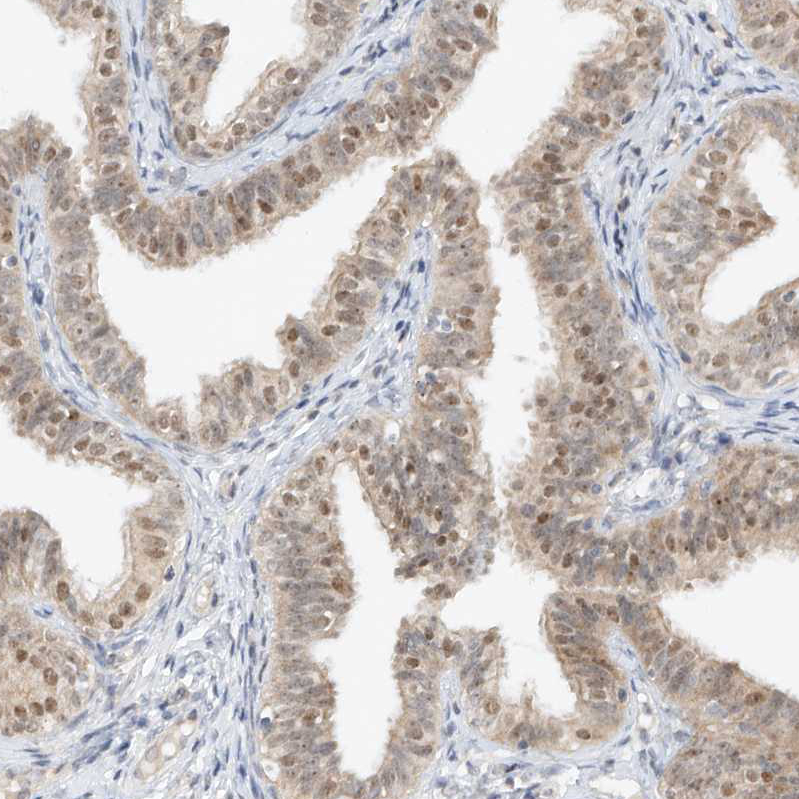 Atlas Antibodies Anti-TASP1 Antibody