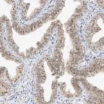 Atlas Antibodies Anti-TASP1 Antibody
