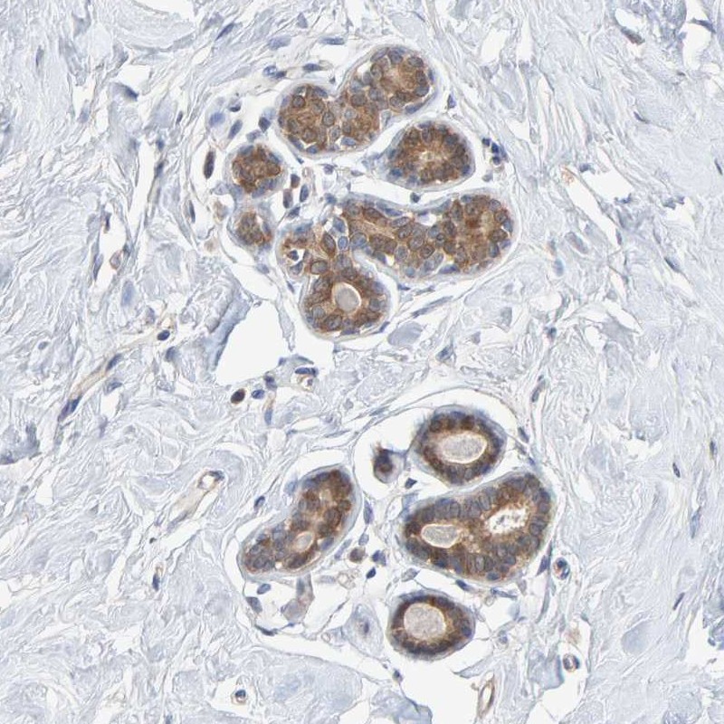 Atlas Antibodies Anti-TATDN1 Antibody