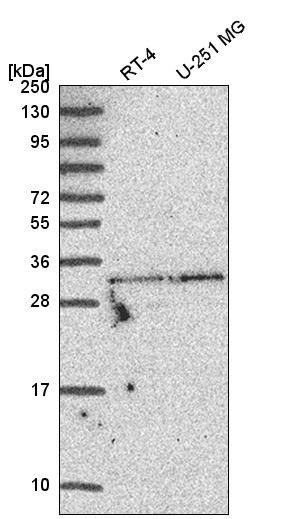 Atlas Antibodies Anti-TATDN1 Antibody