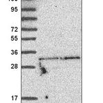 Atlas Antibodies Anti-TATDN1 Antibody
