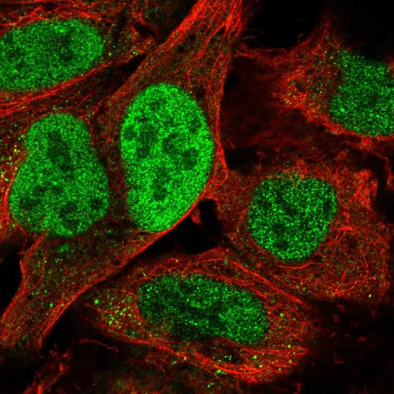 Atlas Antibodies Anti-TATDN2 Antibody