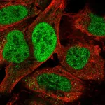 Atlas Antibodies Anti-TATDN2 Antibody