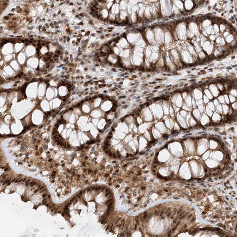 Atlas Antibodies Anti-TATDN3 Antibody