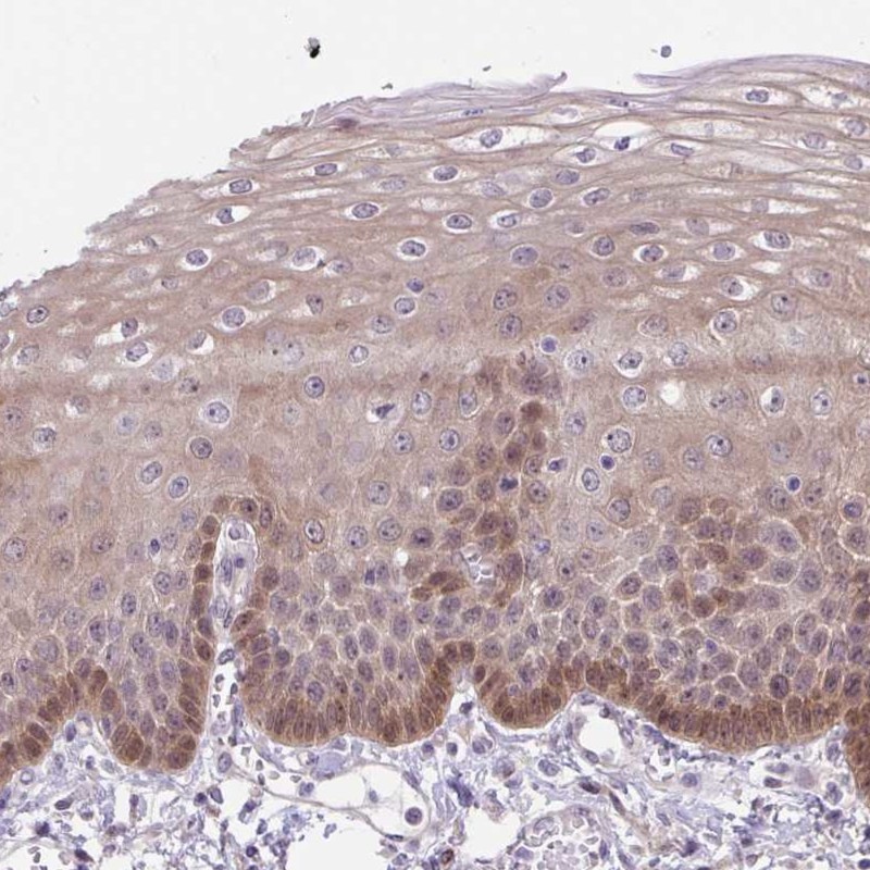 Atlas Antibodies Anti-TAX1BP3 Antibody