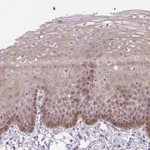 Atlas Antibodies Anti-TAX1BP3 Antibody