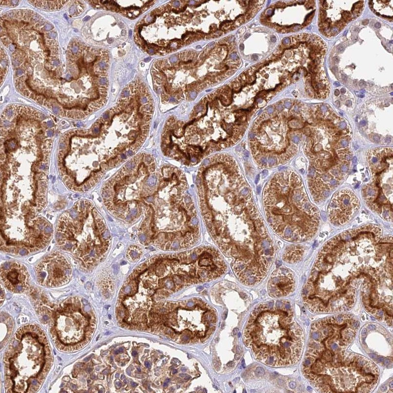 Atlas Antibodies Anti-TBC1D1 Antibody