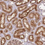 Atlas Antibodies Anti-TBC1D1 Antibody