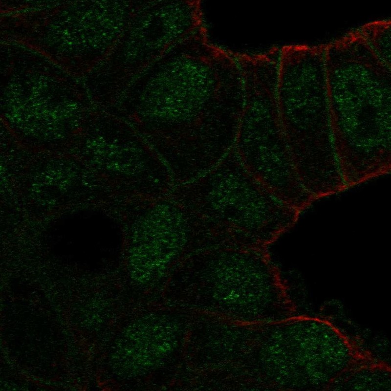 Atlas Antibodies Anti-TBC1D10A Antibody