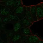 Atlas Antibodies Anti-TBC1D10A Antibody