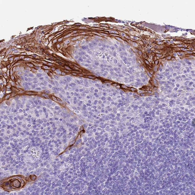 Atlas Antibodies Anti-TBC1D10B Antibody