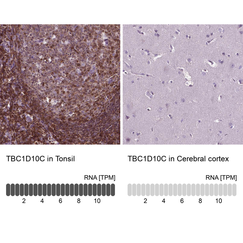 Atlas Antibodies Anti-TBC1D10C Antibody