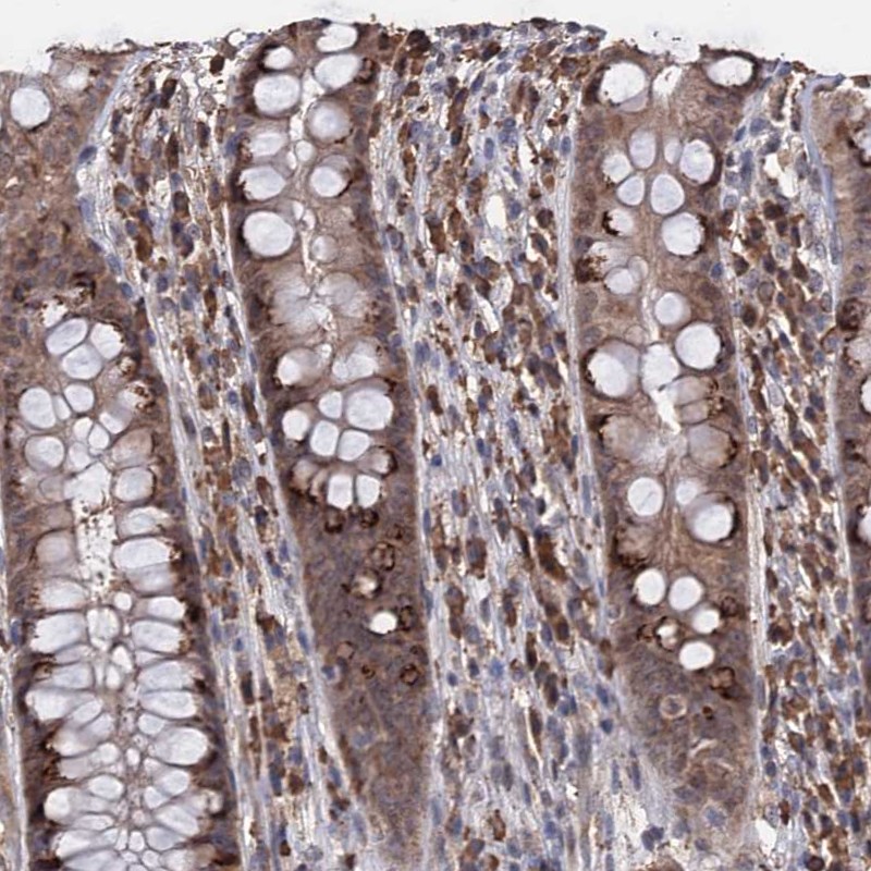 Atlas Antibodies Anti-TBC1D12 Antibody