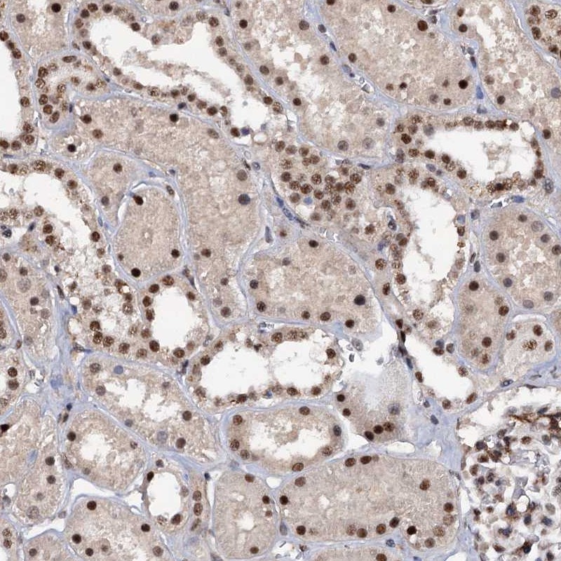 Atlas Antibodies Anti-TBC1D12 Antibody