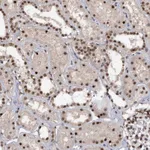 Atlas Antibodies Anti-TBC1D12 Antibody