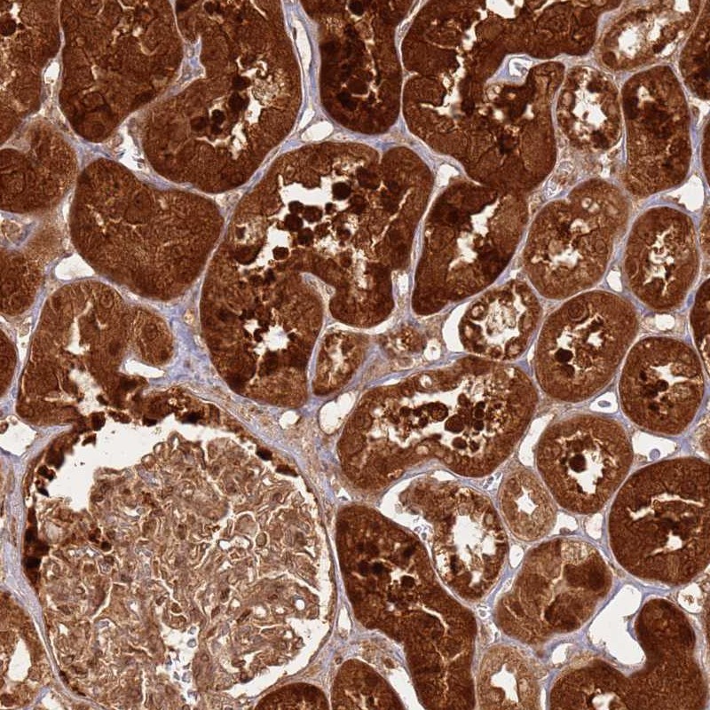 Atlas Antibodies Anti-TBC1D13 Antibody