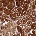 Atlas Antibodies Anti-TBC1D13 Antibody